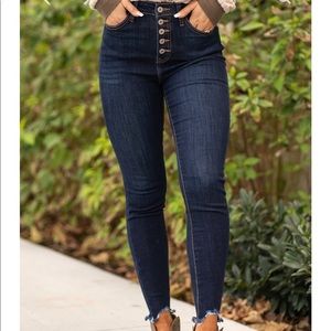 Kancan button fly jeans